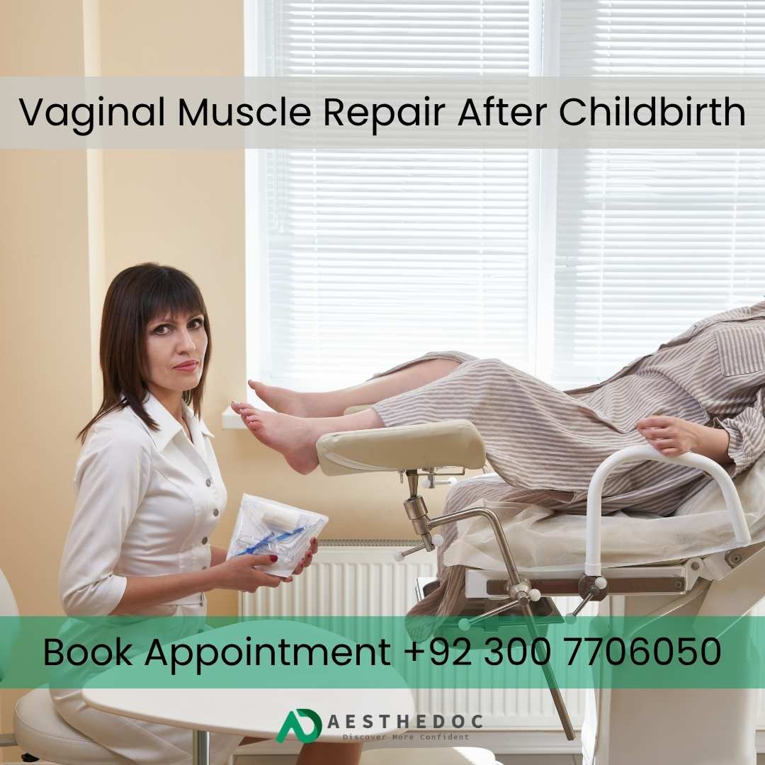 Vaginal Muscle Repair After Childbirth