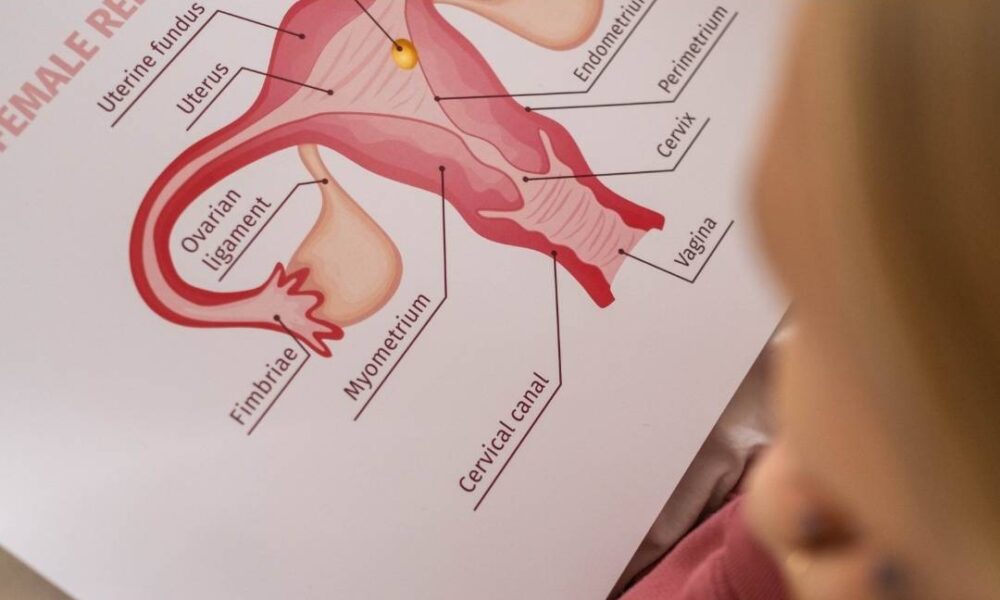 Treatments for Stress Urinary Incontinence