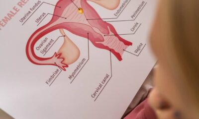 Treatments for Stress Urinary Incontinence