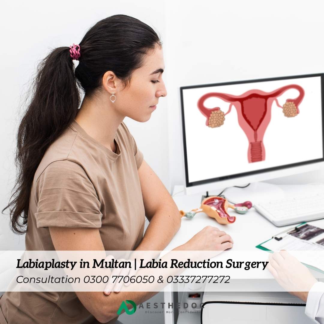 Labiaplasty in Multan Labia Reduction Surgery