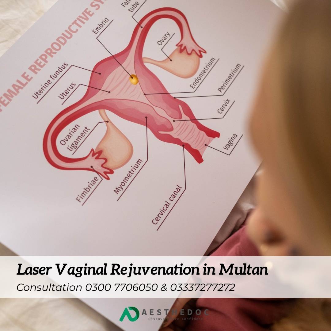 Laser Vaginal Rejuvenation in Multan
