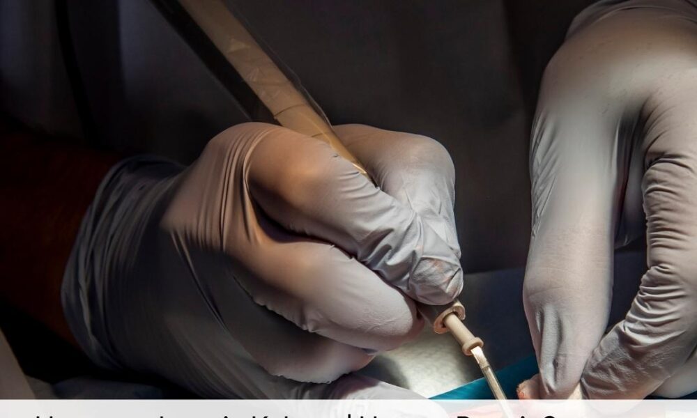 Hymenoplasty in Kahuta Hymen Repair Surgery