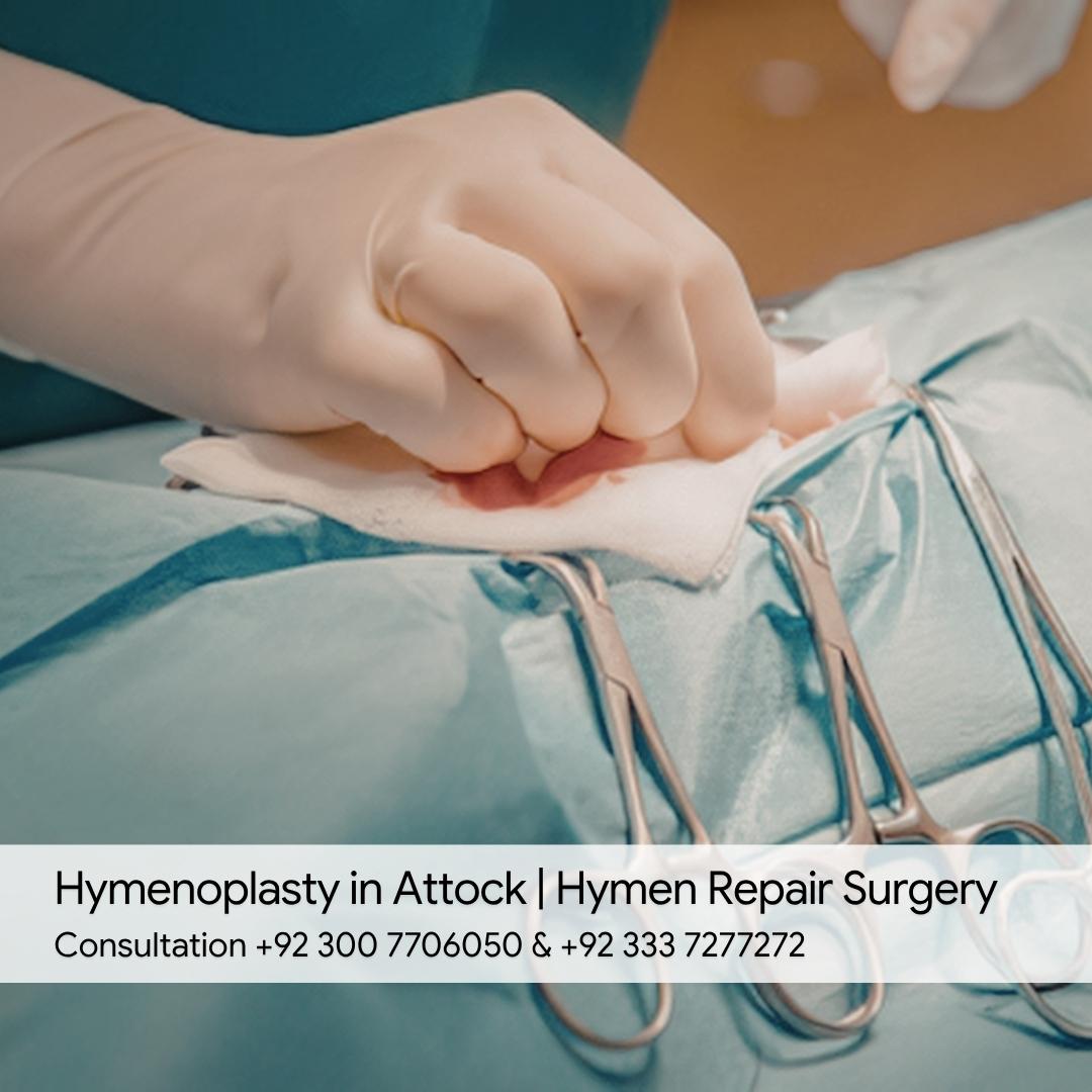 Hymenoplasty in Attock Hymen Repair Surgery