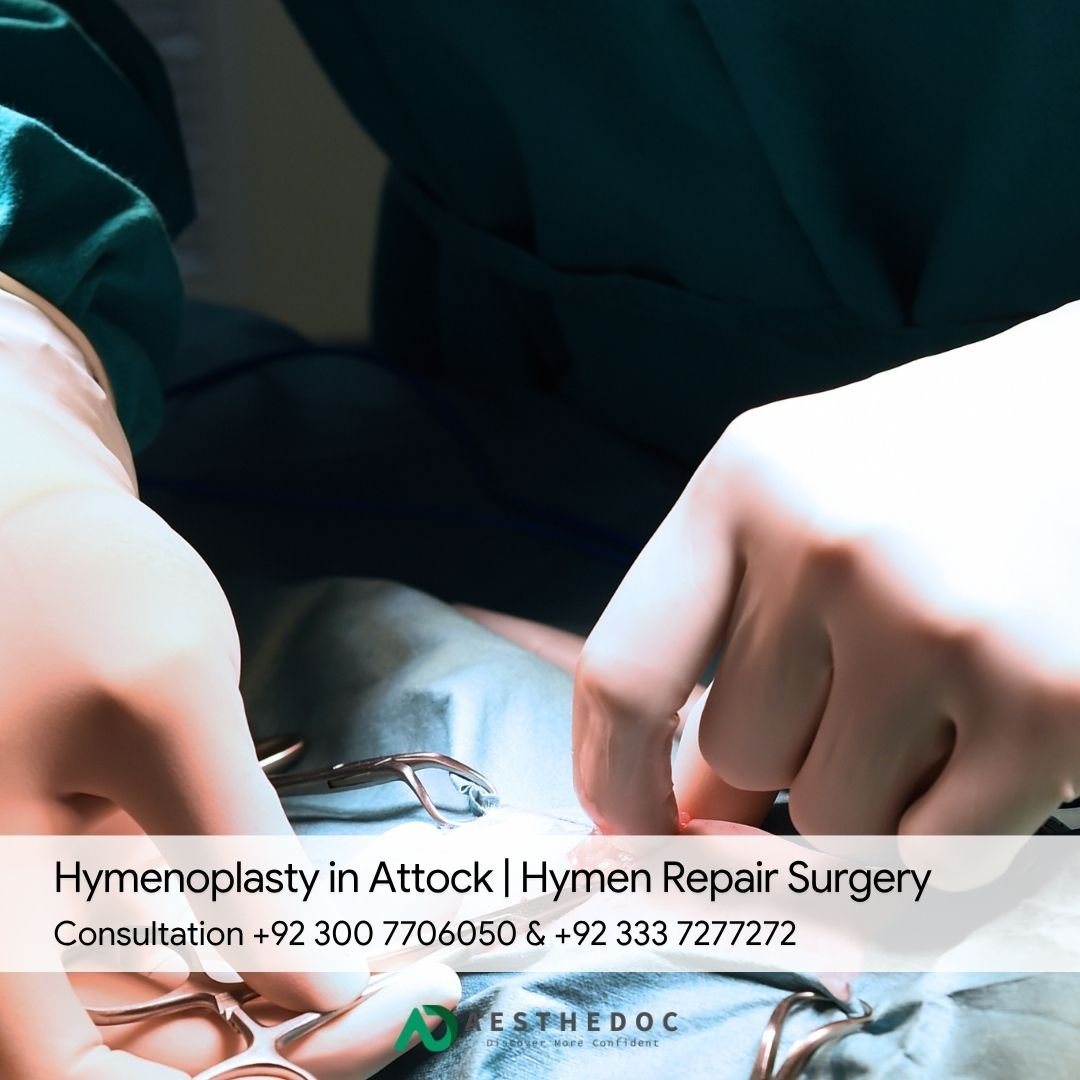Hymenoplasty in Attock | Hymen Repair Surgery
