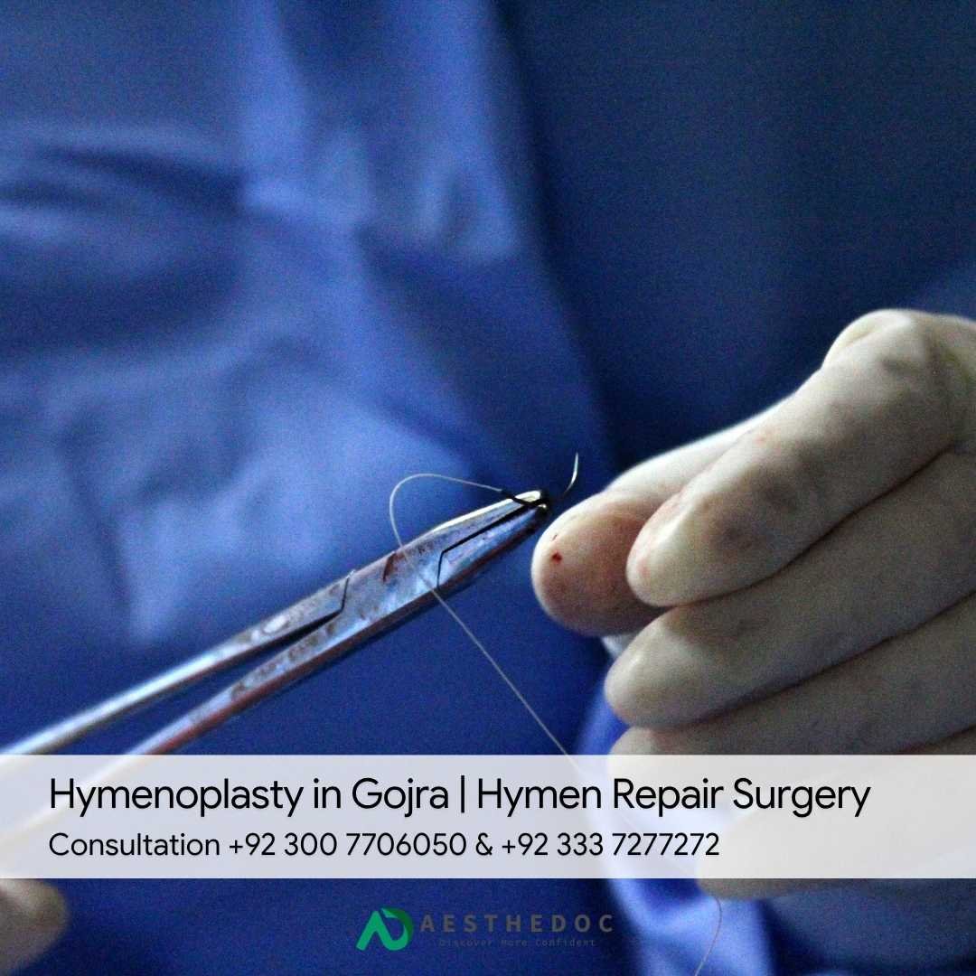 Hymenoplasty in Gojra Hymen Repair Surgery